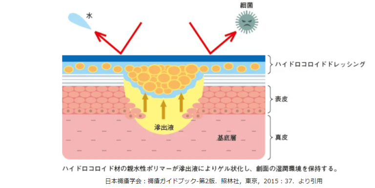 ⑦創傷被覆材を適切に使おう(創傷被覆材おすすめ4選!) | 皮膚科専門医が伝授!医療従事者のための高齢者皮膚トラブル対策講座